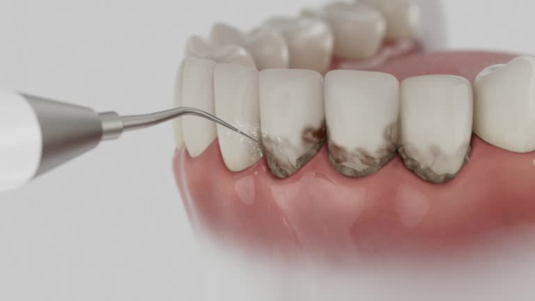 Trusted Root Canal Treatment service in Lyndon, KS - Dentist Open Now